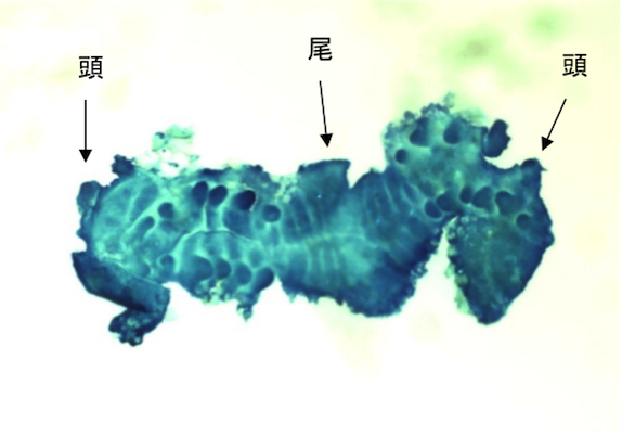アダンソンハエトリグモの重複胚（メチレンブルーで染色）
